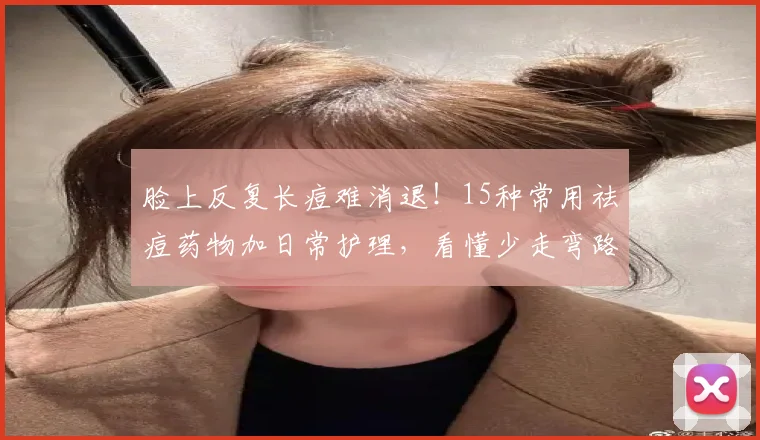 脸上反复长痘难消退！15种常用祛痘药物加日常护理，看懂少走弯路